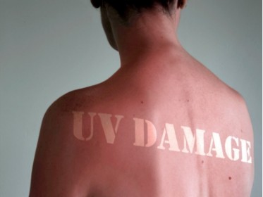 picture of uv damaged skin